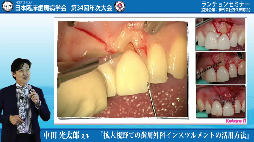 動画紹介］歯周治療をマスターしよう Part2 | Doctorbook academy 